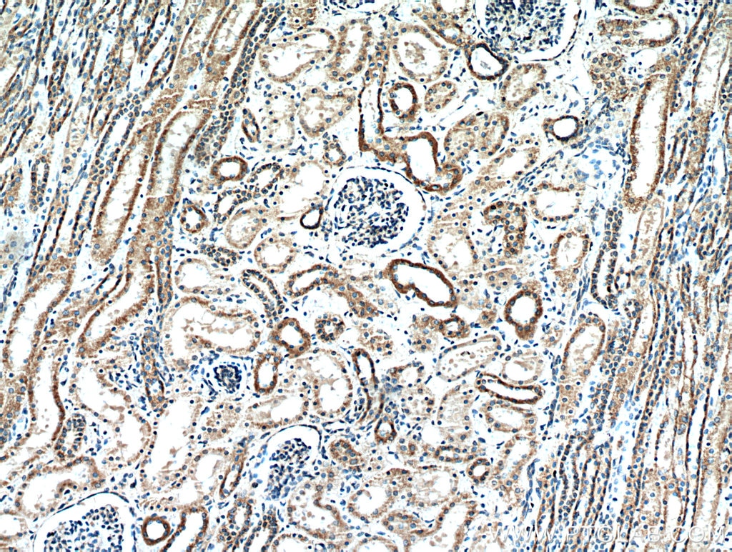 Immunohistochemistry (IHC) staining of human kidney tissue using TACO1/CCDC44 Polyclonal antibody (21147-1-AP)