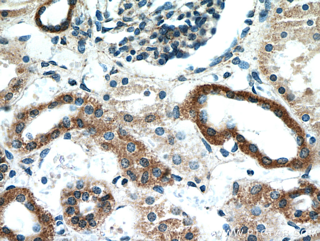 Immunohistochemistry (IHC) staining of human kidney tissue using TACO1/CCDC44 Polyclonal antibody (21147-1-AP)