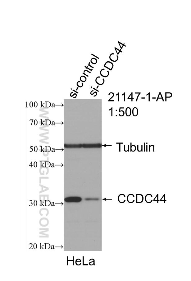 Western Blot (WB) analysis of HeLa cells using TACO1/CCDC44 Polyclonal antibody (21147-1-AP)