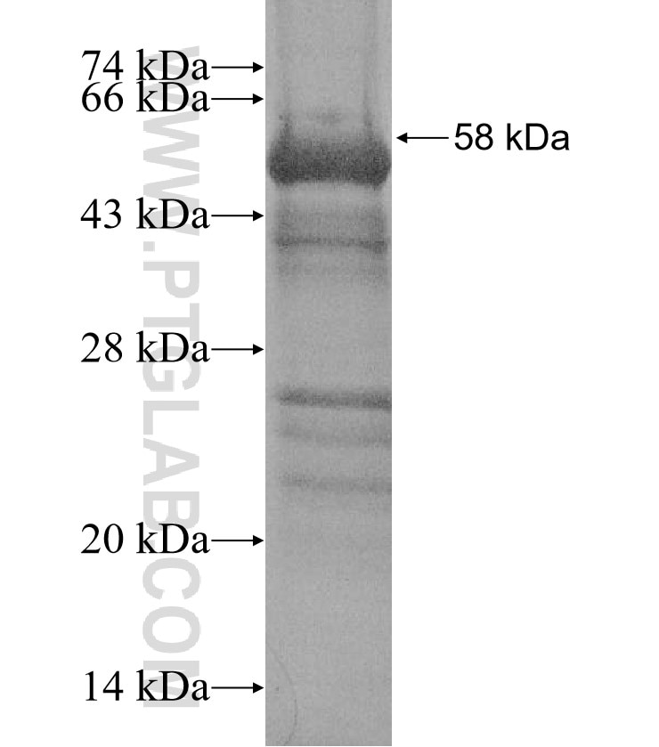 CCDC44 fusion protein Ag15688 SDS-PAGE