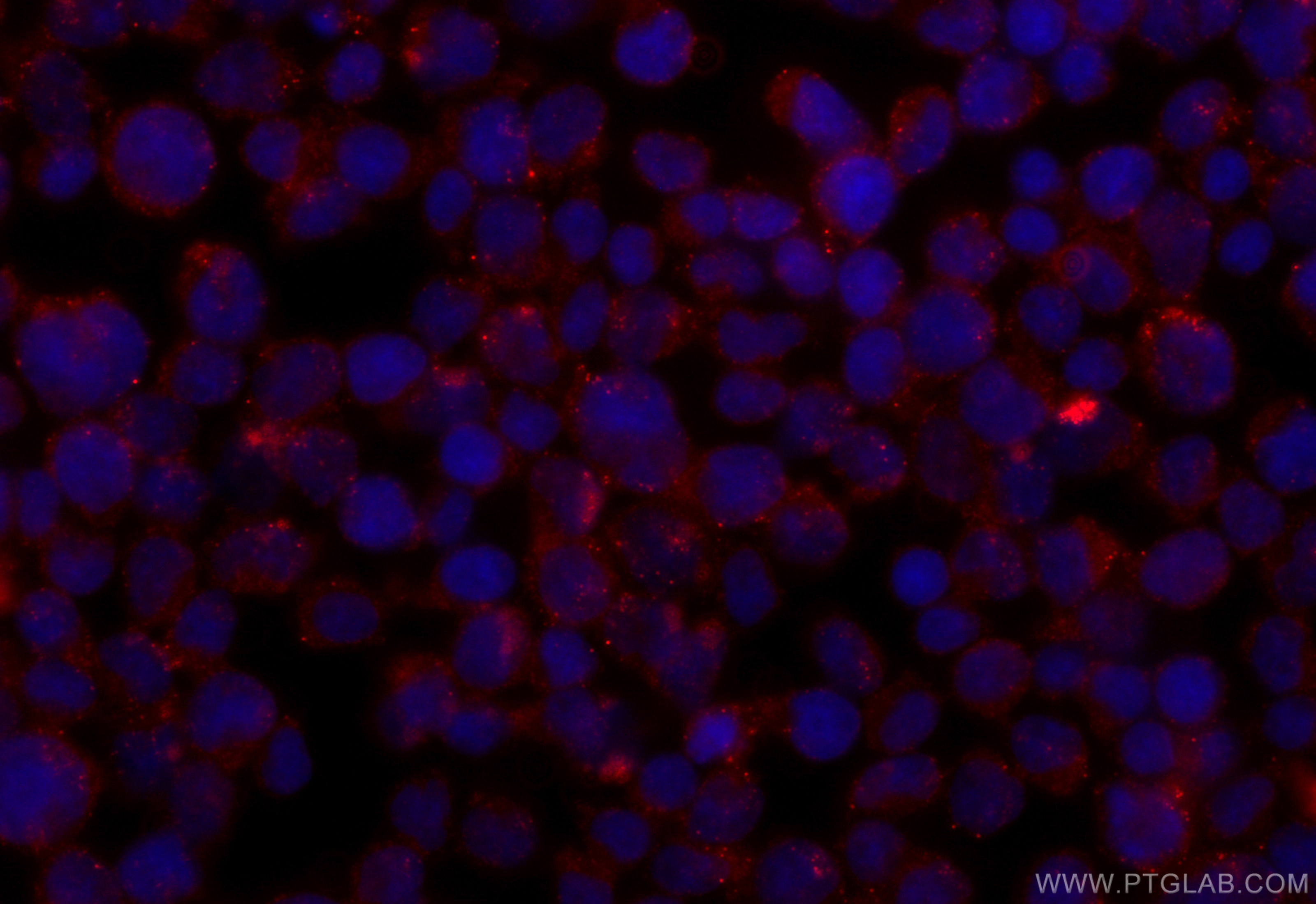 Immunofluorescence (IF) / fluorescent staining of Jurkat cells using CoraLite®594-conjugated CCDC45 Monoclonal antibody (CL594-67755)