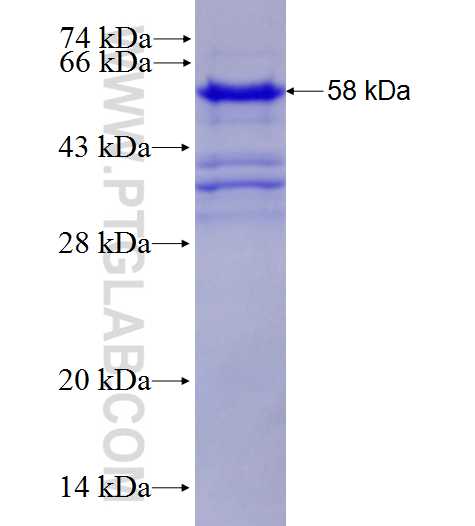 CCDC45 fusion protein Ag27821 SDS-PAGE
