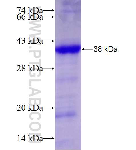 CCDC45 fusion protein Ag27836 SDS-PAGE