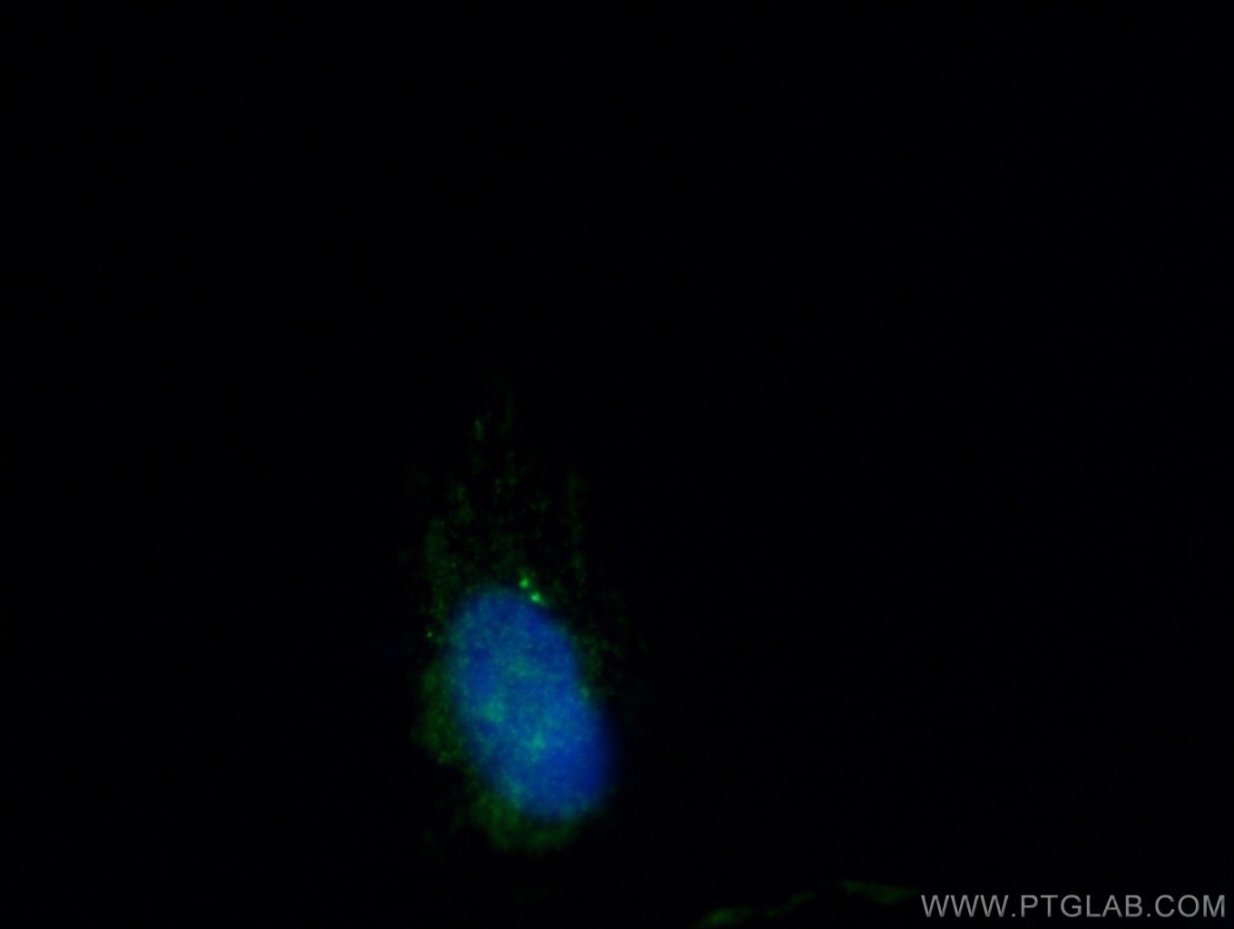 Immunofluorescence (IF) / fluorescent staining of MDCK cells using CEP112 Polyclonal antibody (24928-1-AP)