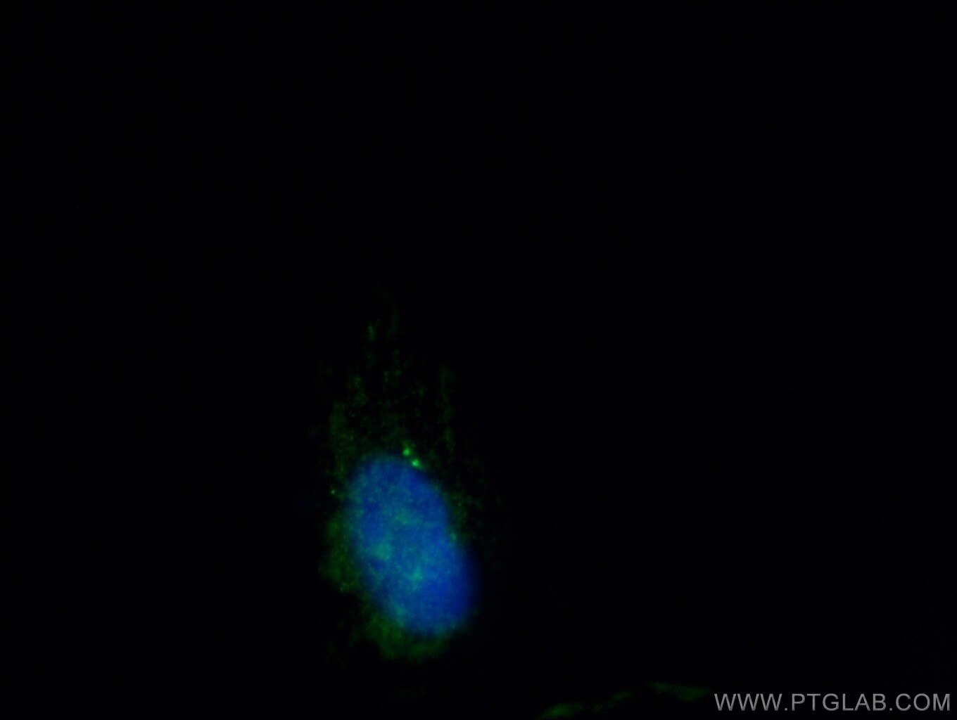 IF Staining of MDCK using 24928-1-AP