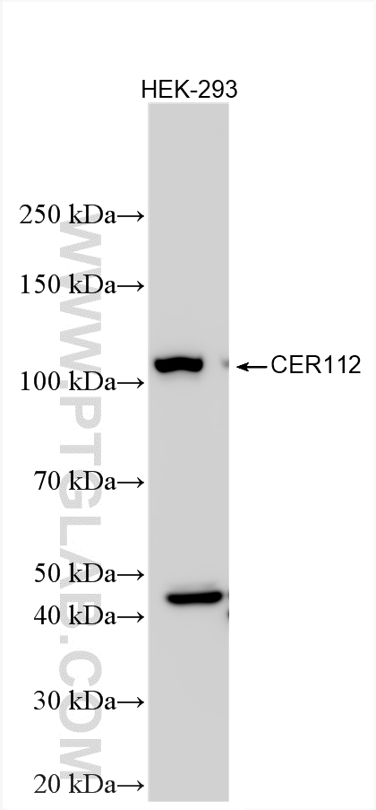Western Blot (WB) analysis of various lysates using CEP112 Polyclonal antibody (24928-1-AP)