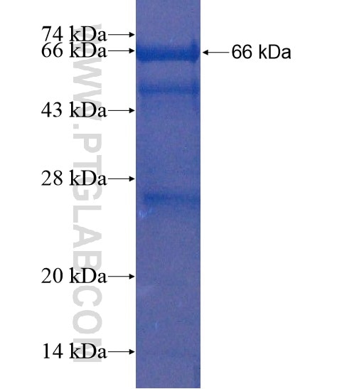 CCDC46 fusion protein Ag21586 SDS-PAGE