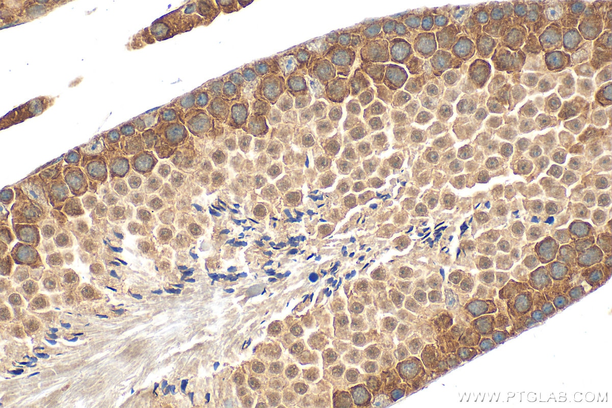 Immunohistochemistry (IHC) staining of mouse testis tissue using CCDC47 Polyclonal antibody (32080-1-AP)
