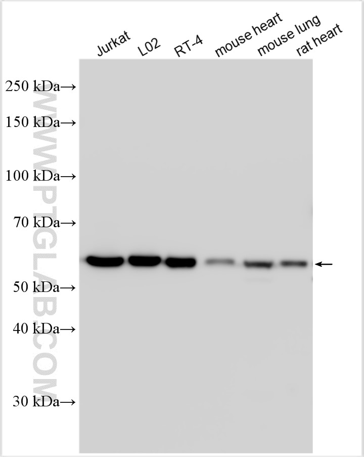 Western Blot (WB) analysis of various lysates using CCDC47 Polyclonal antibody (32080-1-AP)