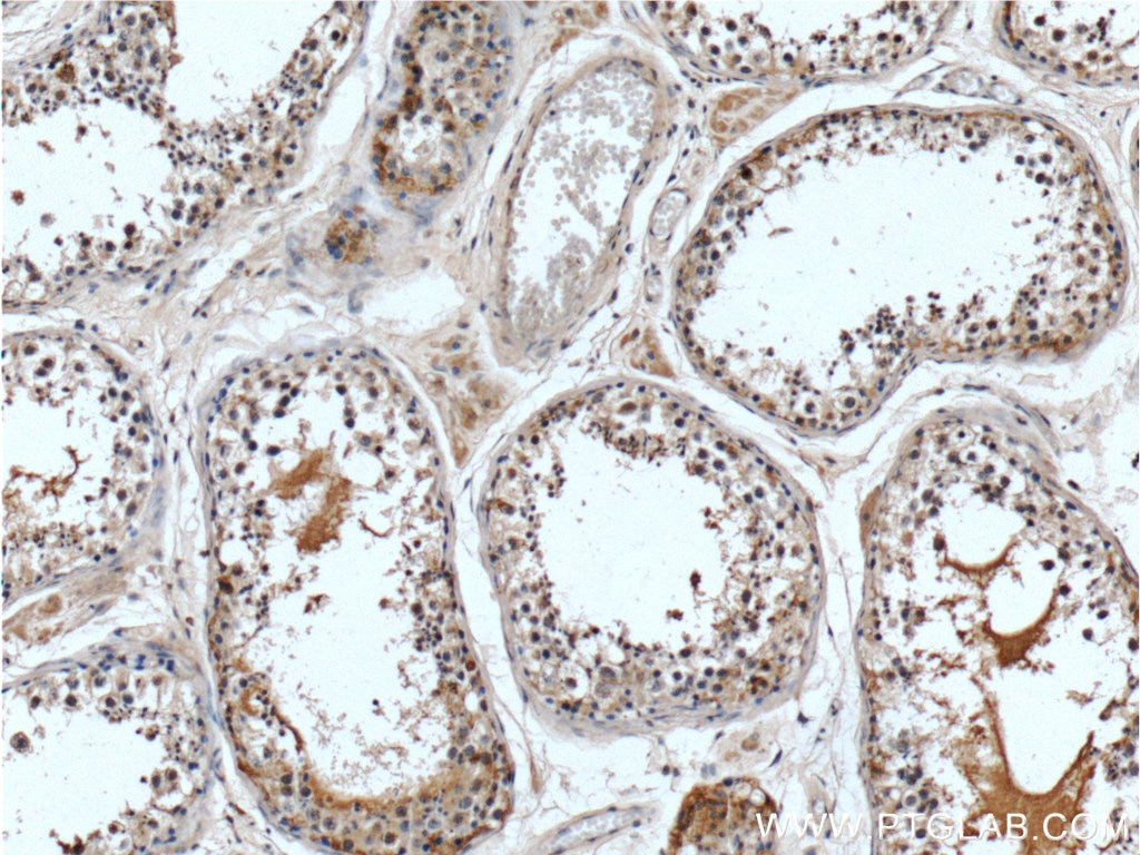 Immunohistochemistry (IHC) staining of human testis tissue using CWC25 Polyclonal antibody (24416-1-AP)