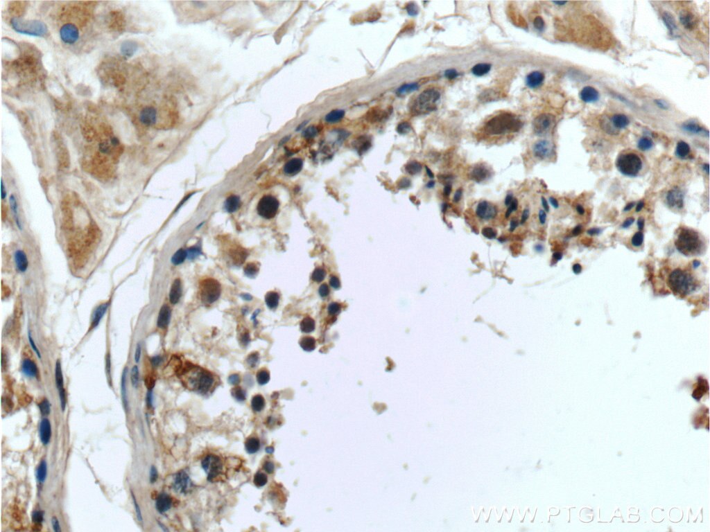 Immunohistochemistry (IHC) staining of human testis tissue using CWC25 Polyclonal antibody (24416-1-AP)