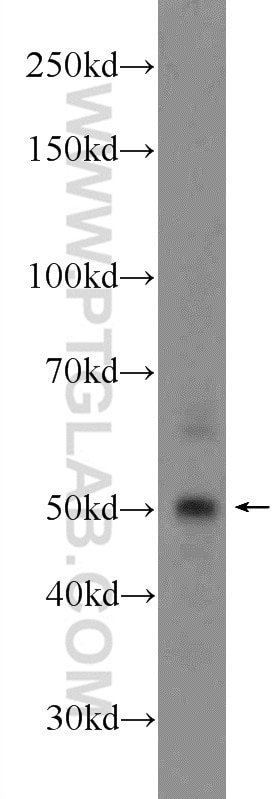 Western Blot (WB) analysis of HeLa cells using CWC25 Polyclonal antibody (24416-1-AP)