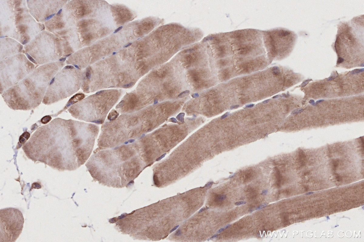 Immunohistochemistry (IHC) staining of mouse skeletal muscle tissue using HAUS1 Polyclonal antibody (11094-2-AP)