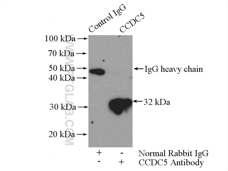 Immunoprecipitation (IP) experiment of HeLa cells using HAUS1 Polyclonal antibody (11094-2-AP)