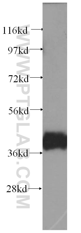 Western Blot (WB) analysis of human skeletal muscle tissue using HAUS1 Polyclonal antibody (11094-2-AP)