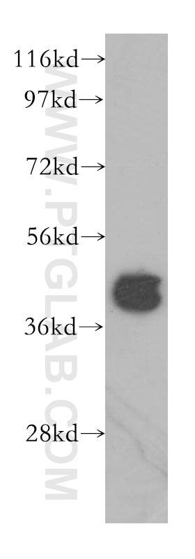Western Blot (WB) analysis of HeLa cells using HAUS1 Polyclonal antibody (11094-2-AP)