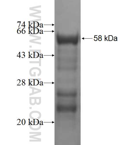 CCDC5 fusion protein Ag1569 SDS-PAGE