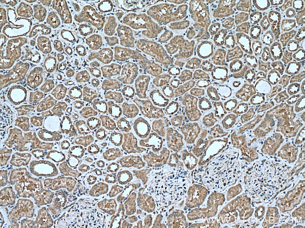 Immunohistochemistry (IHC) staining of human kidney tissue using CCDC50 Polyclonal antibody (21082-1-AP)