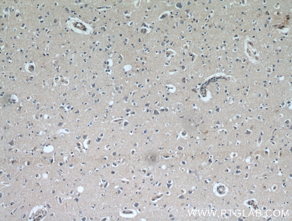 Immunohistochemistry (IHC) staining of human brain tissue using CCDC50 Polyclonal antibody (21082-1-AP)