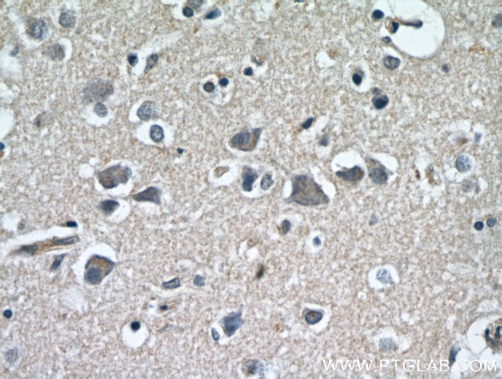 Immunohistochemistry (IHC) staining of human brain tissue using CCDC50 Polyclonal antibody (21082-1-AP)