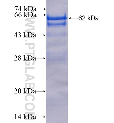 CCDC50 fusion protein Ag15293 SDS-PAGE