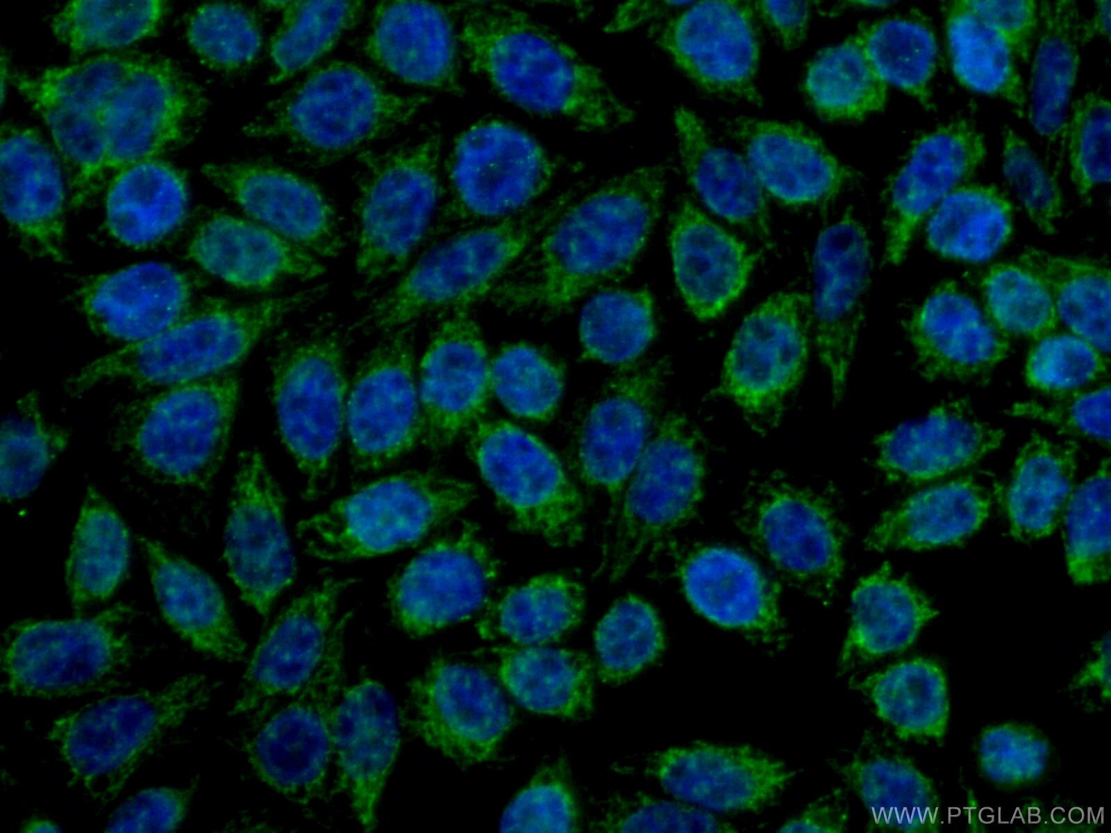 Immunofluorescence (IF) / fluorescent staining of HeLa cells using CCDC51 Polyclonal antibody (20465-1-AP)