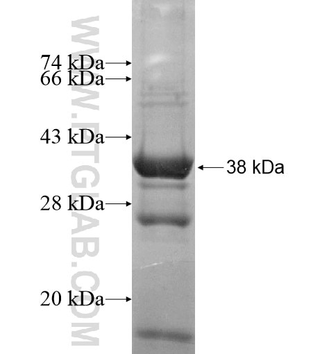 CCDC51 fusion protein Ag14849 SDS-PAGE