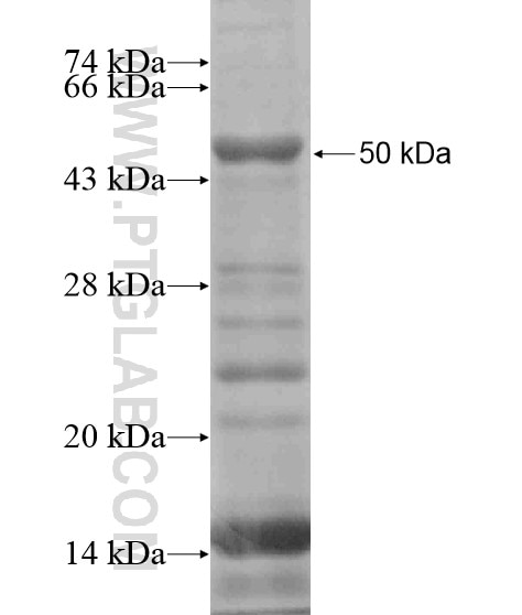 CCDC52 fusion protein Ag19381 SDS-PAGE