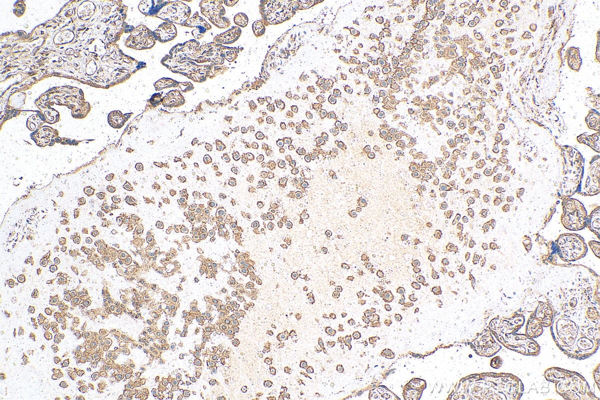 Immunohistochemistry (IHC) staining of human placenta tissue using CCDC53 Polyclonal antibody (24445-1-AP)