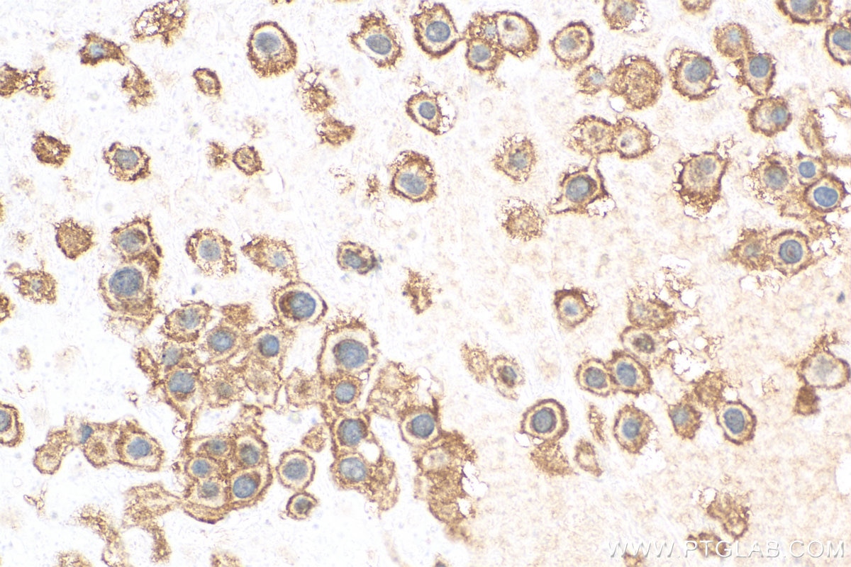 Immunohistochemistry (IHC) staining of human placenta tissue using CCDC53 Polyclonal antibody (24445-1-AP)