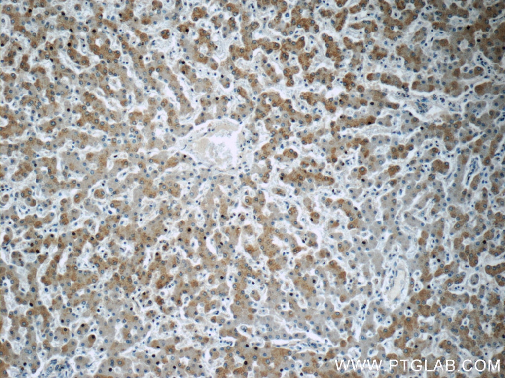 Immunohistochemistry (IHC) staining of human liver tissue using CCDC53 Polyclonal antibody (24445-1-AP)