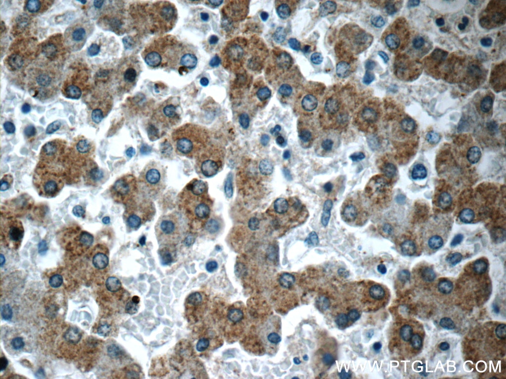 Immunohistochemistry (IHC) staining of human liver tissue using CCDC53 Polyclonal antibody (24445-1-AP)