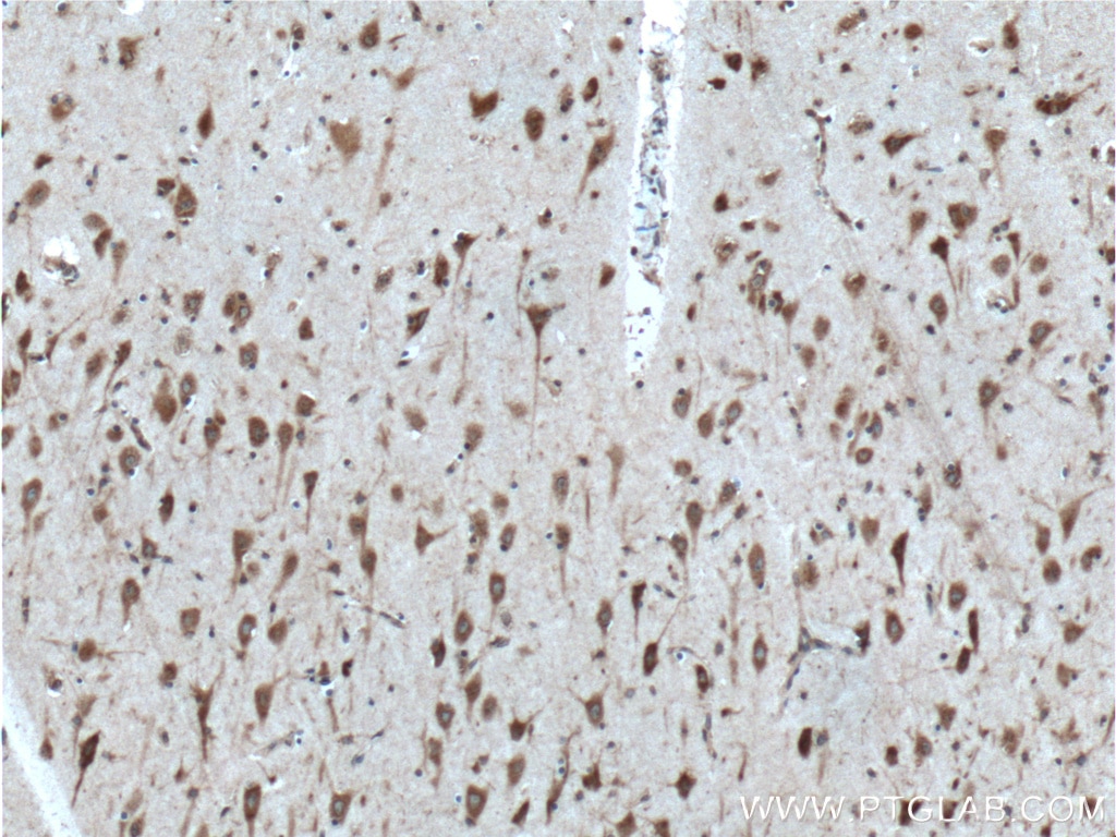 Immunohistochemistry (IHC) staining of human brain tissue using CCDC55 Polyclonal antibody (21360-1-AP)