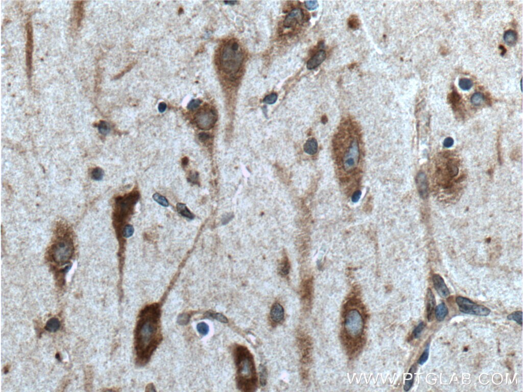 Immunohistochemistry (IHC) staining of human brain tissue using CCDC55 Polyclonal antibody (21360-1-AP)