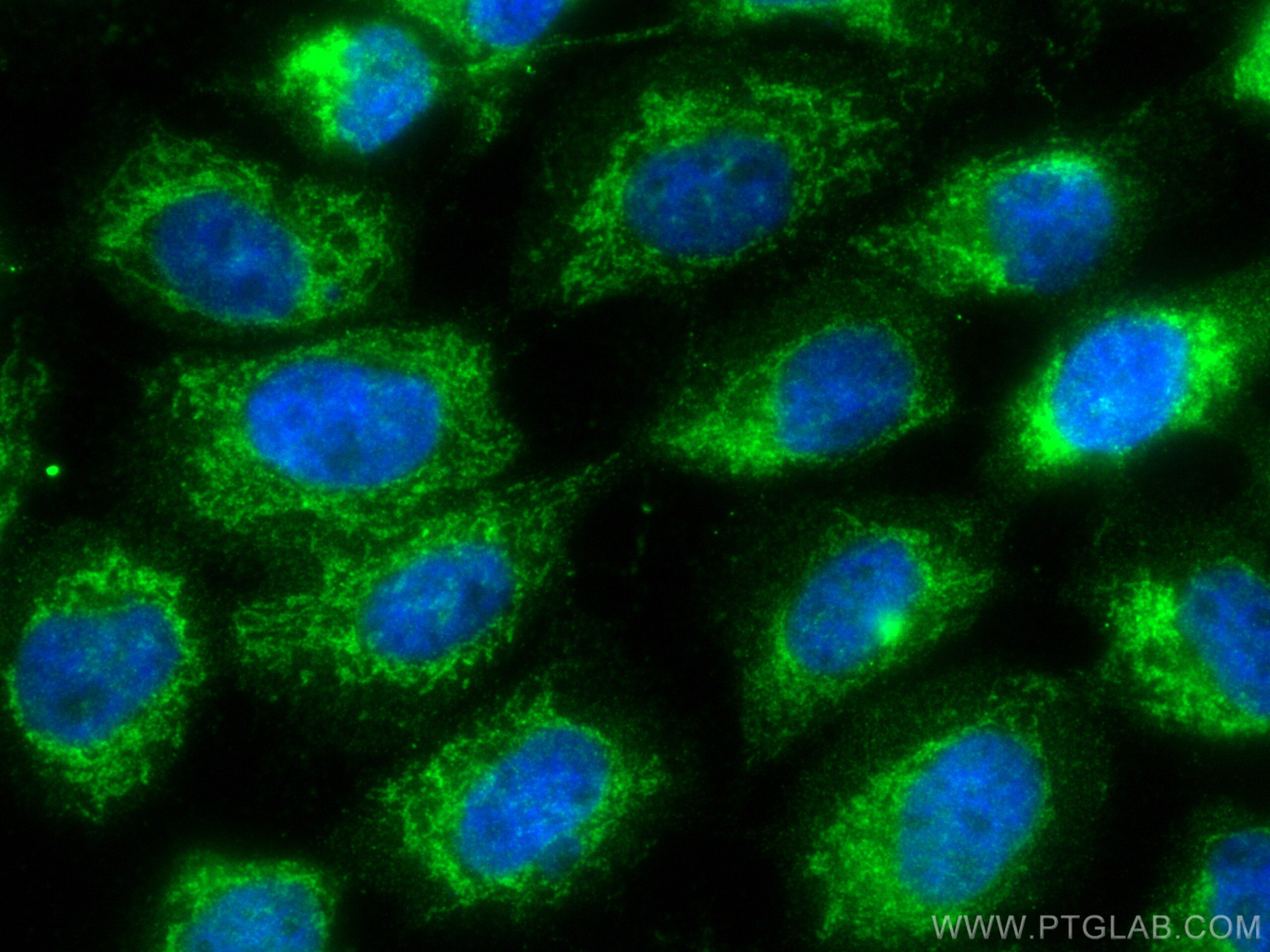 Immunofluorescence (IF) / fluorescent staining of A431 cells using CCDC56/COA3 Polyclonal antibody (20427-1-AP)