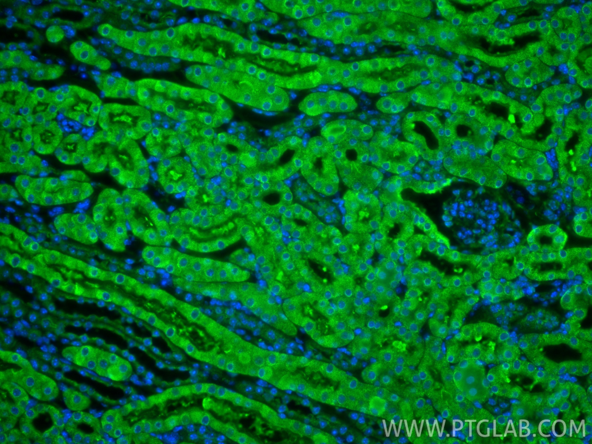IF Staining of mouse kidney using 20427-1-AP Immunofluorescence (IF) / fluorescent staining of mouse kidney tissue using CCDC56/COA3 Polyclonal antibody (20427-1-AP)