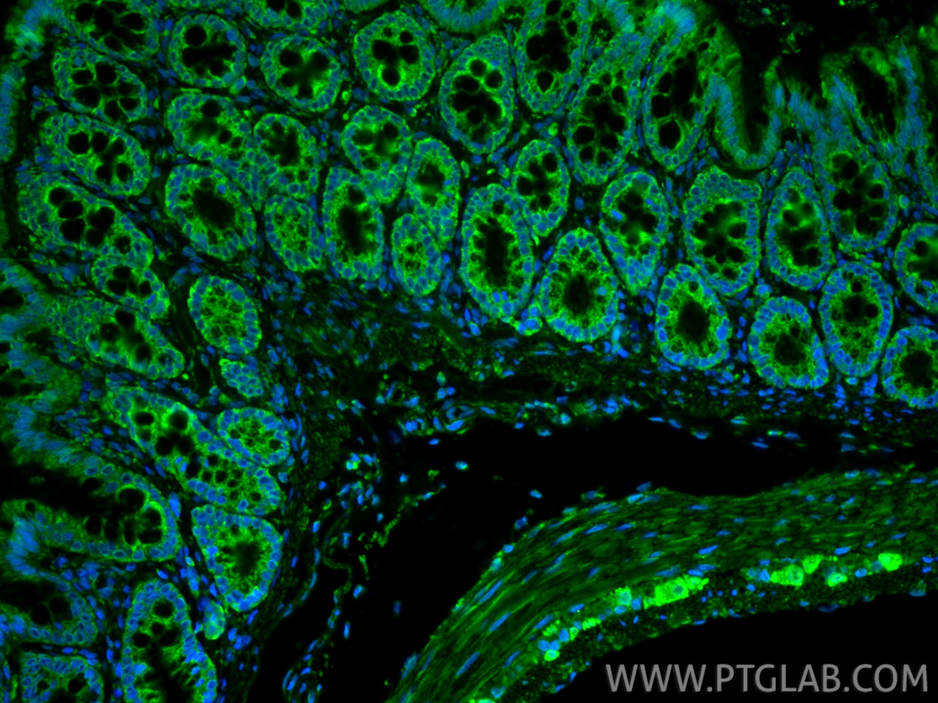 IF Staining of rat colon using 20427-1-AP Immunofluorescence (IF) / fluorescent staining of rat colon tissue using CCDC56/COA3 Polyclonal antibody (20427-1-AP)