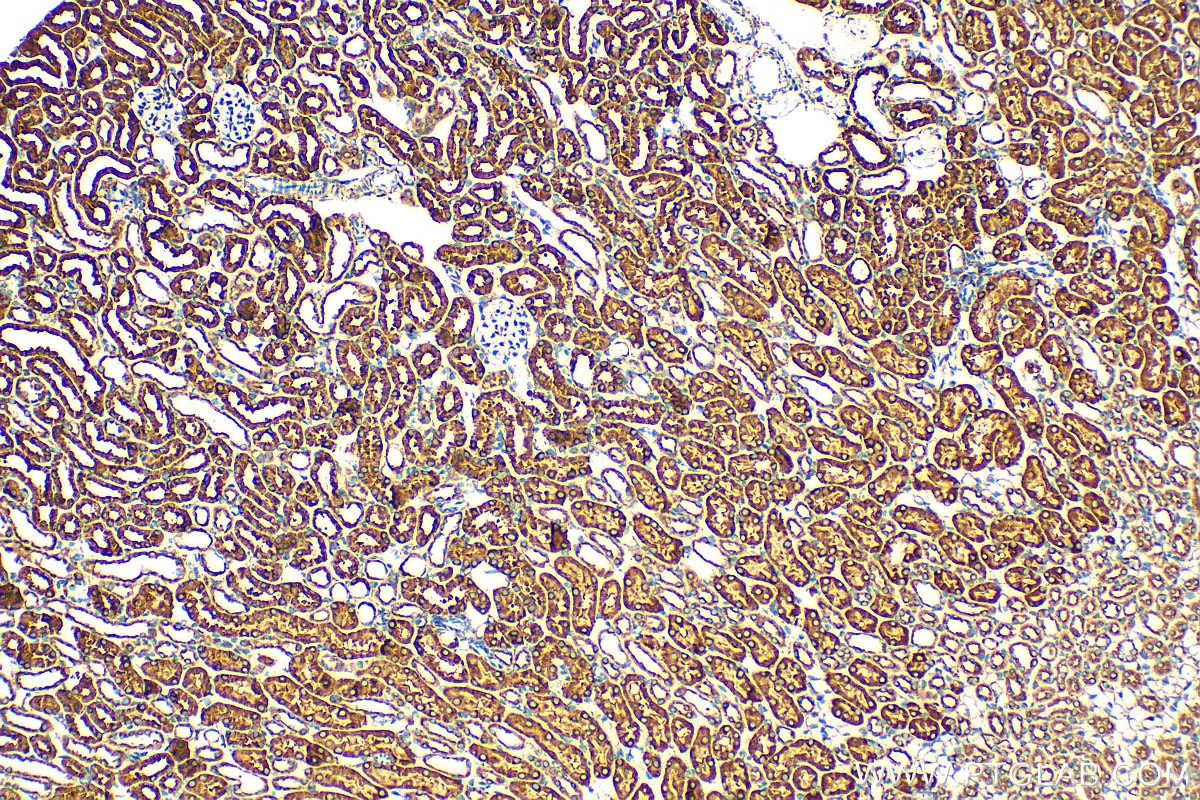 Immunohistochemistry (IHC) staining of mouse kidney tissue using CCDC56/COA3 Polyclonal antibody (20427-1-AP)
