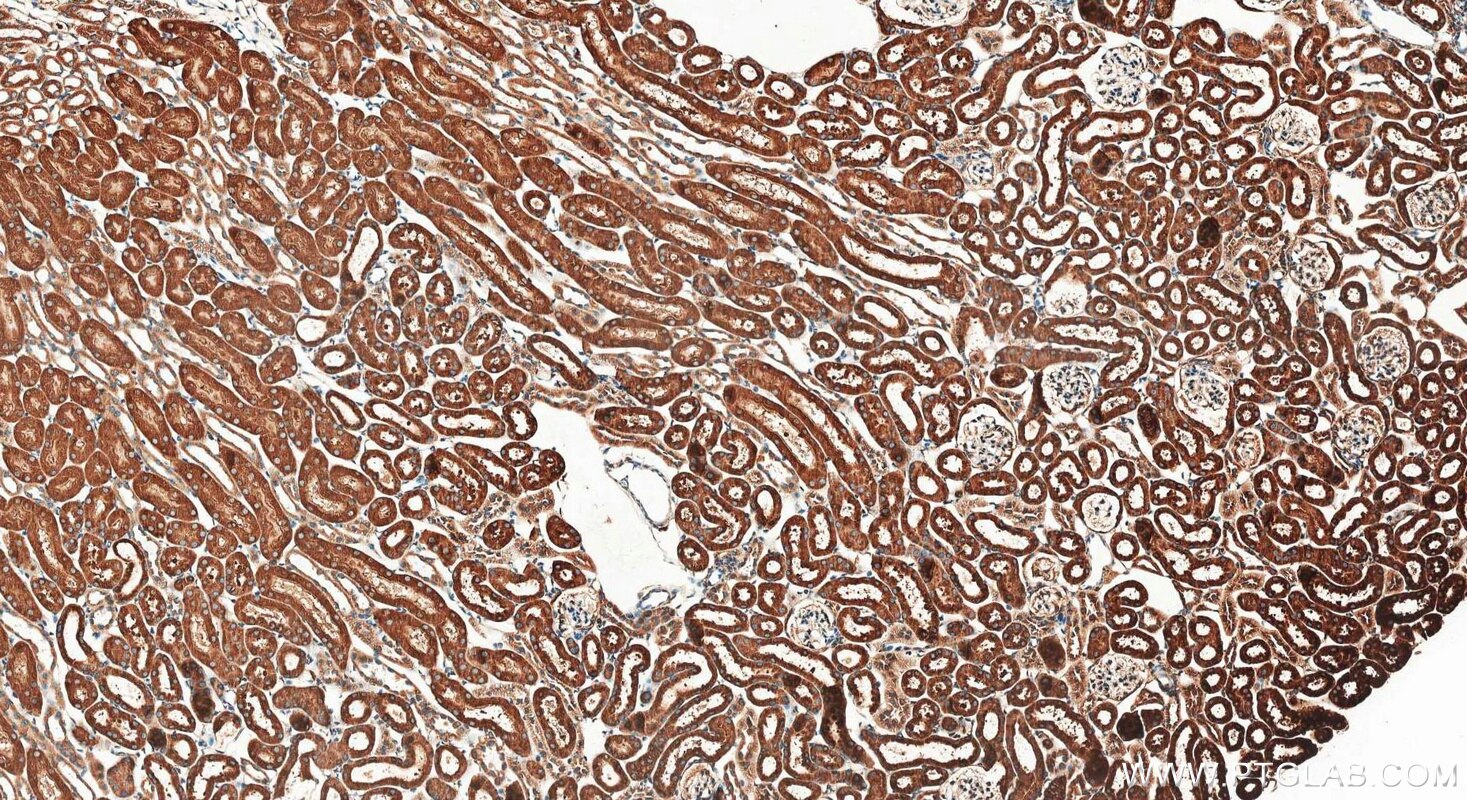 IHC staining of mouse kidney using 20427-1-AP Immunohistochemistry (IHC) staining of mouse kidney tissue using CCDC56/COA3 Polyclonal antibody (20427-1-AP)