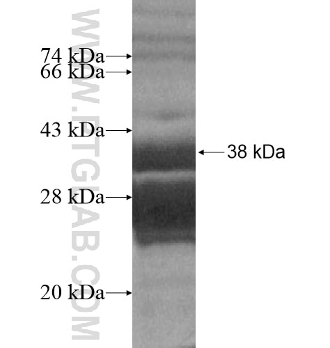 CCDC56 fusion protein Ag14260 SDS-PAGE