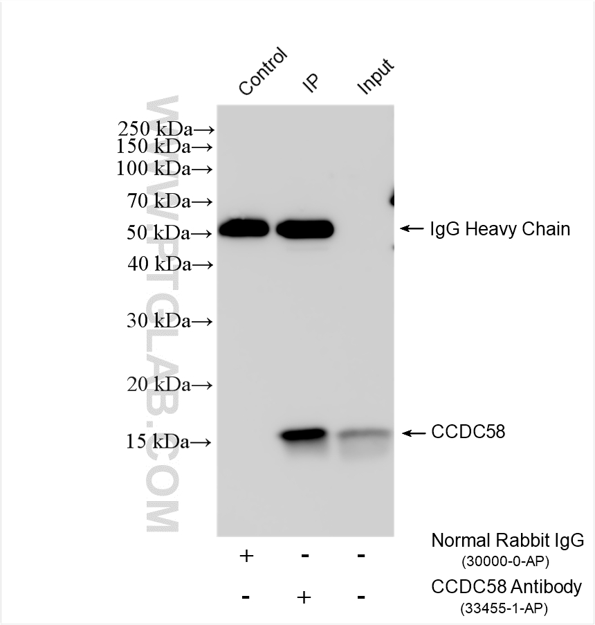 IP experiment of A431 using 33455-1-AP (same clone as 33455-1-PBS) Immunoprecipitation (IP) experiment of A431 cells using CCDC58 Polyclonal antibody (33455-1-AP)