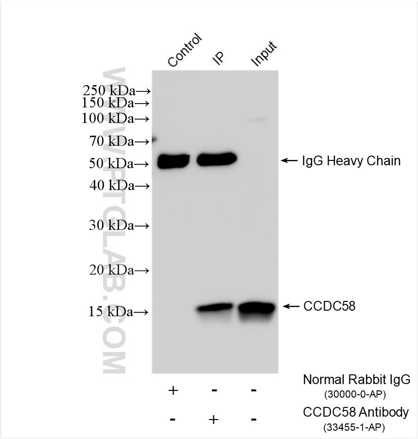 IP experiment of rat kidney using 33455-1-AP (same clone as 33455-1-PBS) Immunoprecipitation (IP) experiment of rat kidney tissue using CCDC58 Polyclonal antibody (33455-1-AP)