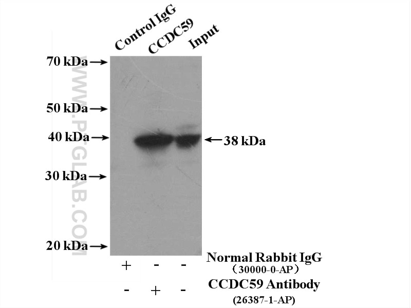 Immunoprecipitation (IP) experiment of HepG2 cells using CCDC59 Polyclonal antibody (26387-1-AP)
