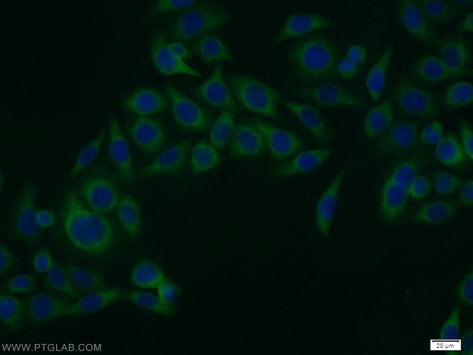 Immunofluorescence (IF) / fluorescent staining of MCF-7 cells using CCDC6 Polyclonal antibody (13717-1-AP)