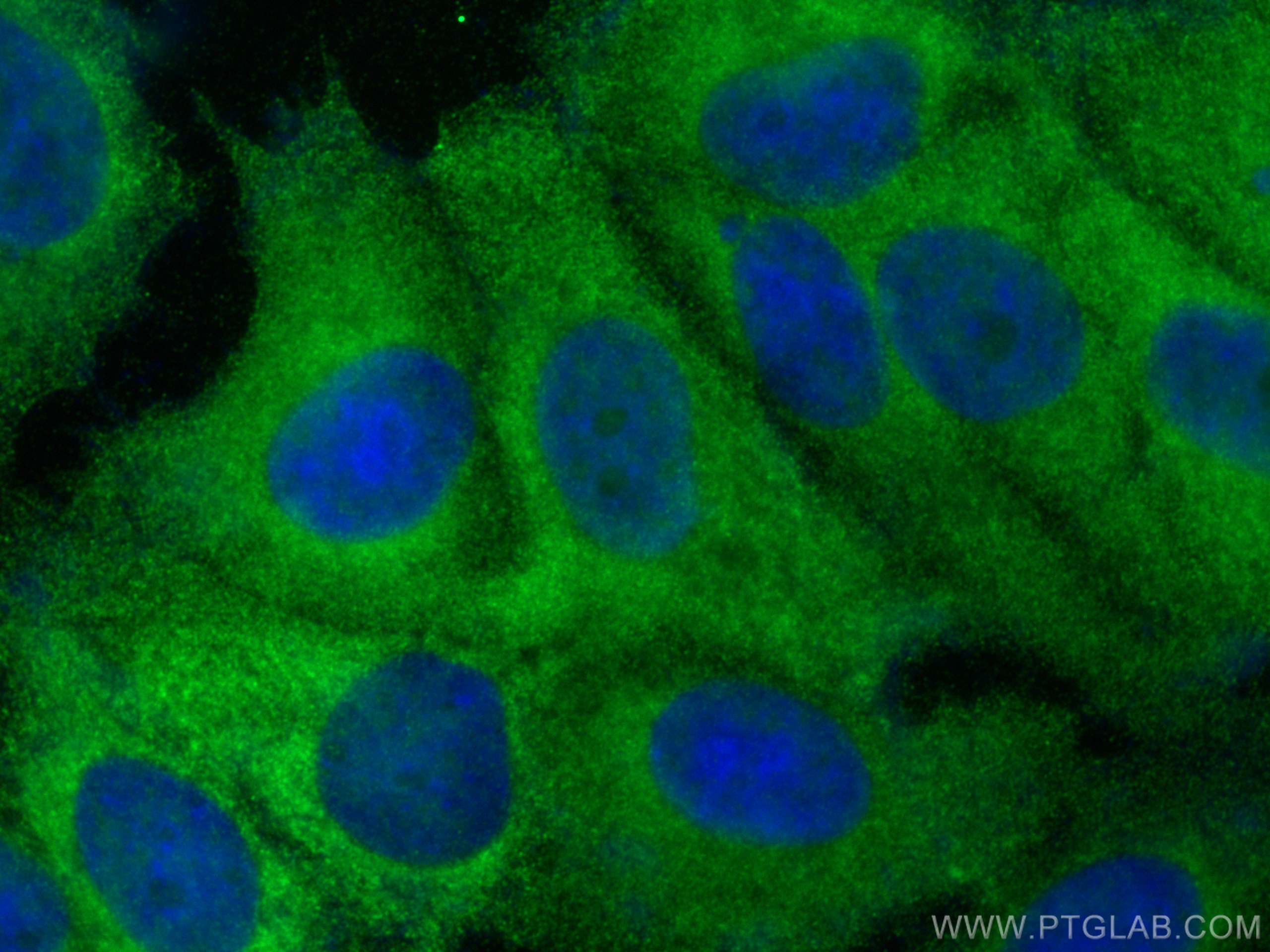 Immunofluorescence (IF) / fluorescent staining of MCF-7 cells using CCDC6 Polyclonal antibody (13717-1-AP)