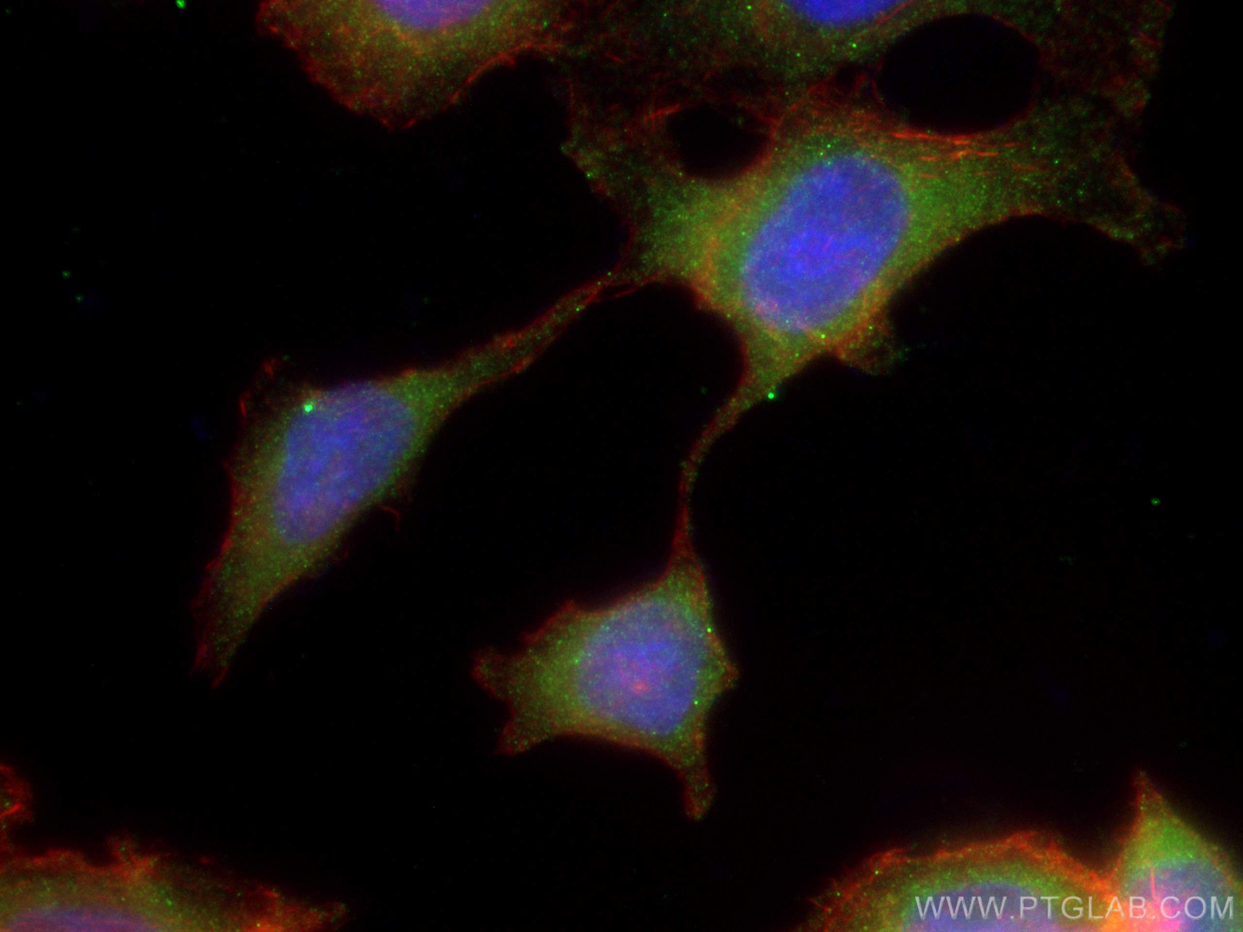 Immunofluorescence (IF) / fluorescent staining of MCF-7 cells using CCDC6 Monoclonal antibody (67637-1-Ig)