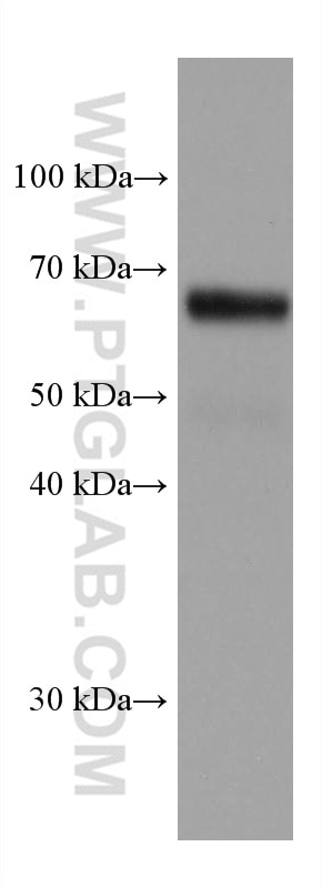 Western Blot (WB) analysis of U2OS cells using CCDC6 Monoclonal antibody (67637-1-Ig)