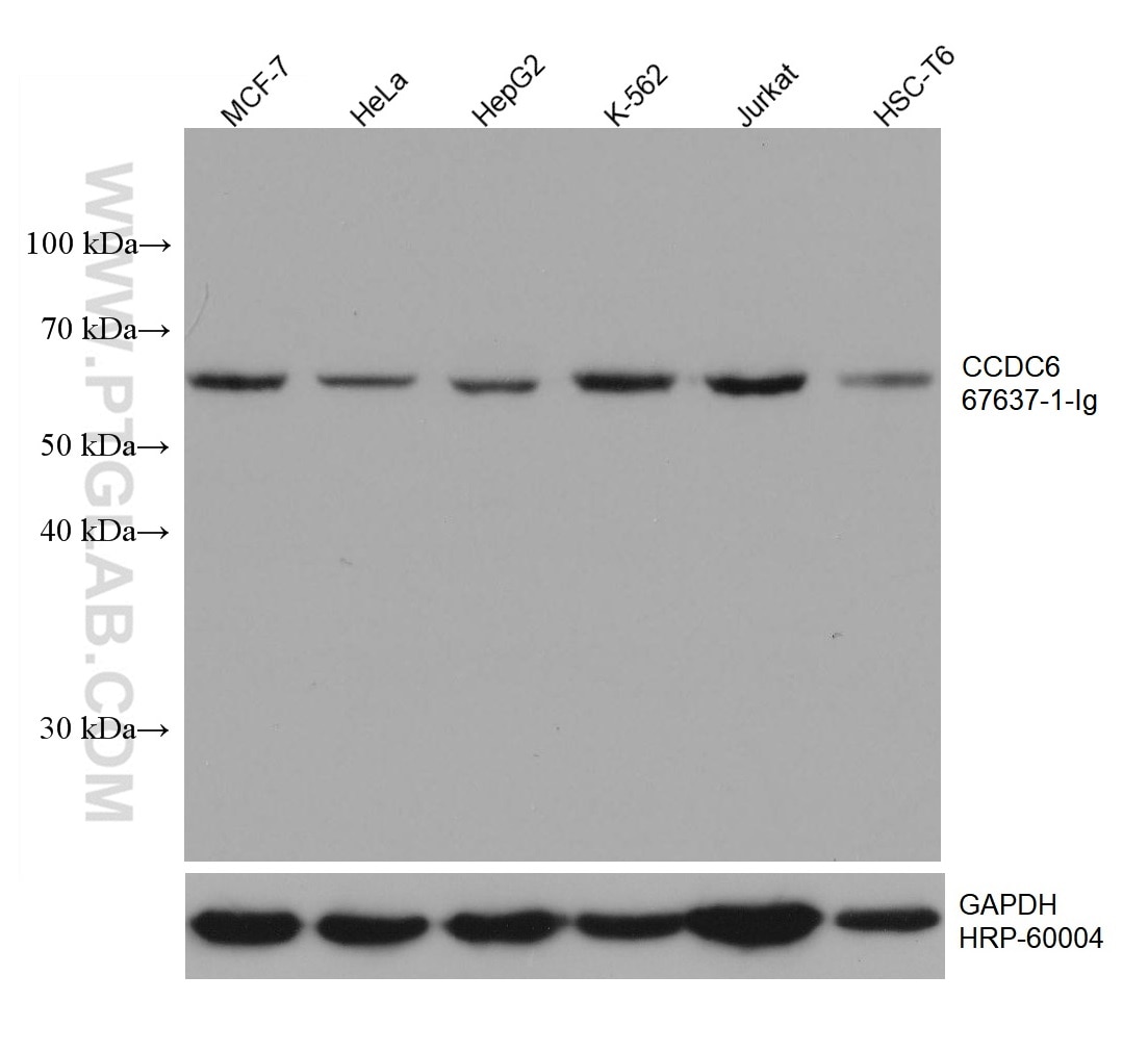Western Blot (WB) analysis of various lysates using CCDC6 Monoclonal antibody (67637-1-Ig)