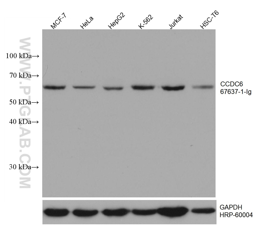 Western Blot (WB) analysis of various lysates using CCDC6 Monoclonal antibody (67637-1-Ig)