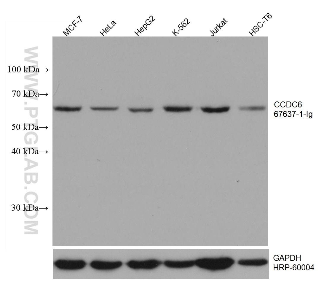 WB analysis using 67637-1-Ig